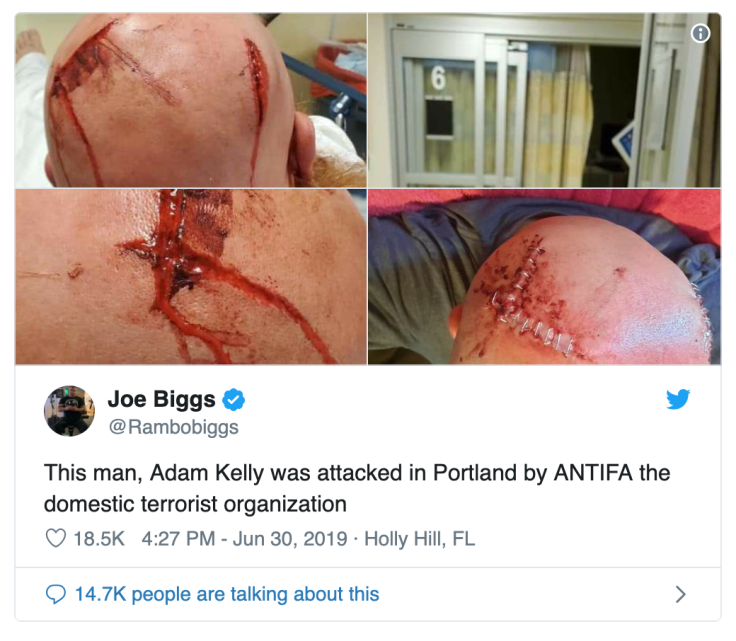 Screen Shot 2019-07-01 at 11.31.56 AM